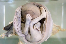 Điều khiếp đảm ở bảo tàng rùng rợn nhất Thái Lan