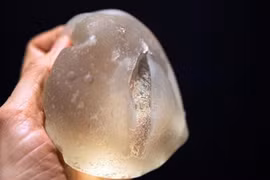 Nổ túi ngực khi đi máy bay, bác sĩ nói có nổ vỡ được không, sự thực bất ngờ