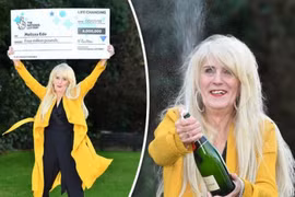 Nữ tài xế chi ngay 1 tỷ đồng sửa răng sau khi trúng số