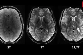Siêu máy quét MRI cho hình ảnh rõ nét nhất về bộ não người