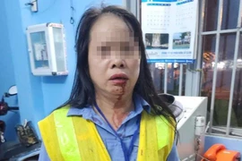 Vấn đề pháp lý vụ nhân viên gác tàu bị đánh gãy xương mũi