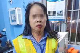 Vấn đề pháp lý vụ nhân viên gác tàu bị đánh gãy xương mũi