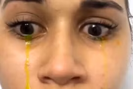 Cô gái hốt hoảng khi khóc ra nước mắt màu vàng 