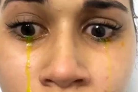 Cô gái hốt hoảng khi khóc ra nước mắt màu vàng 