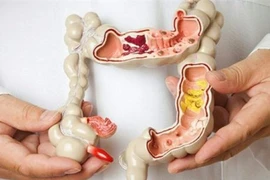 Hàng triệu người Việt vệ sinh sai cách sau đại tiện, tăng nguy cơ bệnh tật 