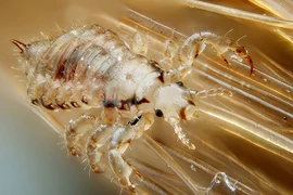 Rận mu có phải bệnh lây truyền qua đường tình dục?