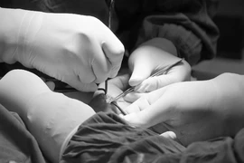 Biết gì căn bệnh khiến người phụ nữ đau nhức, tê bì tay suốt 1 năm?