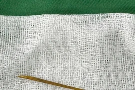 Người phụ nữ thủng ruột non do... tăm tre