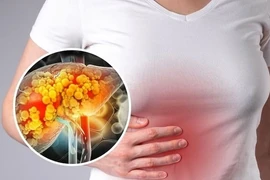 5 loại lá thảo dược là “khắc tinh” của gan nhiễm mỡ