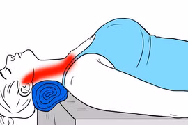 Đau cổ vai gáy do dùng điện thoại di động sai tư thế, khắc phụ sao?