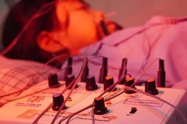 Bé gái 4,5 tuổi bị liệt dây thần kinh số 7 ngoại biên do lạnh