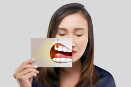 5 dấu hiệu ở miệng có thể "cảnh báo" gan đang gặp vấn đề