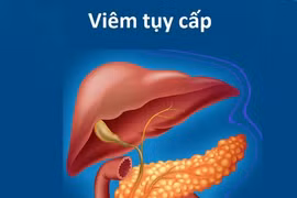 Máu trắng đục như sữa vì ăn uống vô độ, mắc bệnh gì?