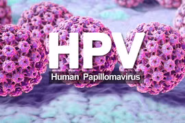 Cách gì phòng ngừa nhiễm HPV ở nam giới?