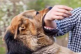 Bé trai tử vong sau 3 tháng bị chó dại cắn, bác sĩ cảnh báo