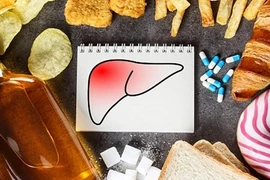 4 thực phẩm tưởng vạn người mê lại là "kẻ thù số 1" của lá gan