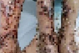 Viêm da nhiễm trùng nặng sau lội nước đắp lá