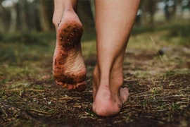 Đi chân trần nhiễm “khuẩn ăn thịt người”, bác sĩ cảnh báo