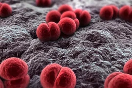 Hơn 10% dân số có thể mang vi khuẩn não mô cầu