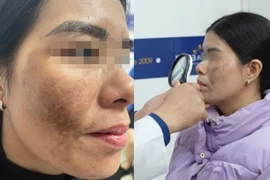 Vội vàng làm đẹp đón Tết - coi chừng "tiền mất - tật mang"