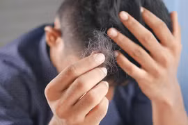 8 dấu hiệu mãn dục ở nam giới