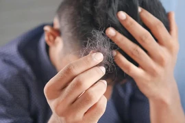 8 dấu hiệu mãn dục ở nam giới