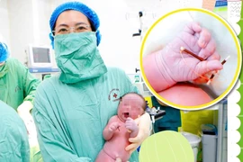 Hy hữu: Bé trai chào đời cùng với vòng tránh thai của mẹ