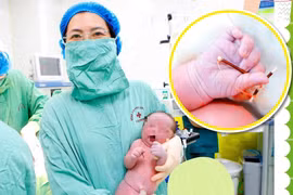 Hy hữu: Bé trai chào đời cùng với vòng tránh thai của mẹ