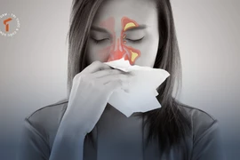 [LONGFORM]: Khổ sở vì viêm xoang mùa lạnh… bác sĩ mách bí kíp phòng ngừa