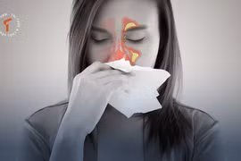 [LONGFORM]: Khổ sở vì viêm xoang mùa lạnh… bác sĩ mách bí kíp phòng ngừa