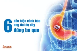 6 dấu hiệu cảnh báo ung thư dạ dày, đừng bỏ qua