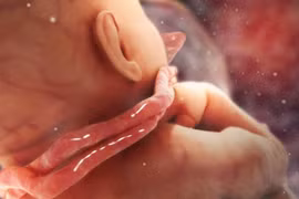 Cận cảnh em bé chào đời với 3 vòng hoa quấn cổ: Cẩn thận biến chứng