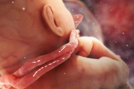 Cận cảnh em bé chào đời với 3 vòng hoa quấn cổ: Cẩn thận biến chứng