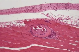 "Điểm mặt" loại ký sinh trùng có mặt trong tiết canh, lòng lợn tái