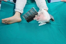 Bé trai 12 tuổi bị kẹp chân vào thang cuốn khi đi trung tâm thương mại