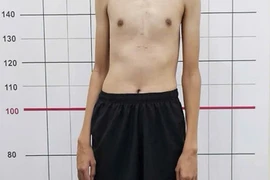 Nam sinh 14 tuổi đã cao gần 2m, bác sĩ chỉ rõ lý do