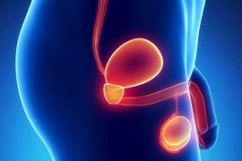 Tinh hoàn bên to bên nhỏ có đáng lo?