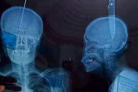 Video: Kinh dị người đàn ông tự đâm dao xuyên đầu để...thở tốt hơn