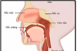 Dùng xạ trị điều trị ung thư vòm hầu