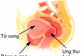 Tác dụng phụ xạ trị và hoá trị?