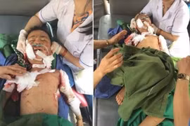 Kinh hoàng bé trai 7 tuổi bị chó cắn tử vong