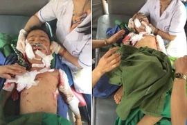 Kinh hoàng bé trai 7 tuổi bị chó cắn tử vong