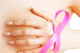 Hay chóng mặt, buồn nôn, đi khám phát hiện ung thư vú