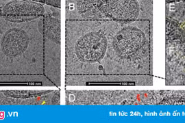 Ảnh hiển vi đầu tiên cho thấy hình dạng thật của virus Corona