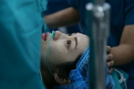 Xóa tàn nhang và bớt bằng laser, cô gái mất mạng vì...