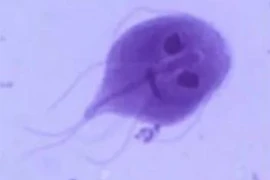 Xem kết quả xét nghiệm, bác sĩ run người thấy hình ảnh "bóng ma mặt quỷ"