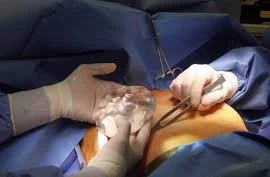 Thẩm mỹ Dr. Vinh Lê bị tước giấy phép hoạt động