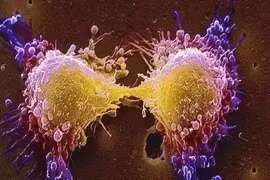 Kinh ngạc cách tế bào ung thư chống lại hóa trị