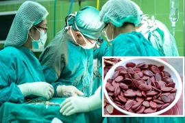 Ăn hạt dưa không nhả vỏ, thiếu nữ khiến bác sĩ sợ tái mặt vì...