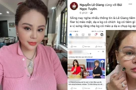 Lê Giang phủ nhận thông tin tiêm filler đến mức 'méo mặt'